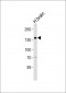 OVOS1 Antibody (Center)